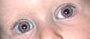 Пример применения фильтра Удаление эффекта красных глаз